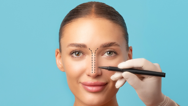 Rhinoplasty